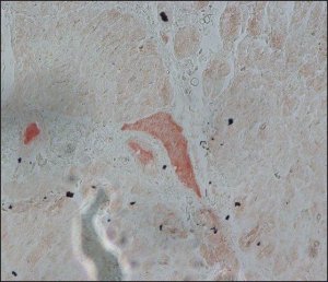 Anti-Fibroblast Growth Factor Receptor-2, Extracellular antibody produced in rabbit 