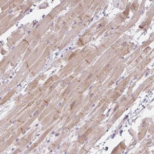 Anti-FILIP1 antibody produced in rabbit 