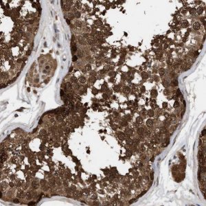 Anti-FITM1 antibody produced in rabbit 
