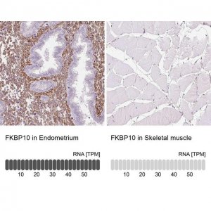 Anti-FKBP10 antibody produced in rabbit 