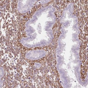 Anti-FKBP10 antibody produced in rabbit 