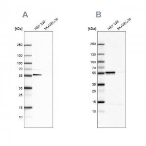 Anti-FKBP5 antibody produced in rabbit HPA031092-100UL