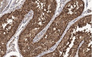 Anti-FKBP52 Antibody, clone 4H21 ZooMAb Rabbit Monoclonal 