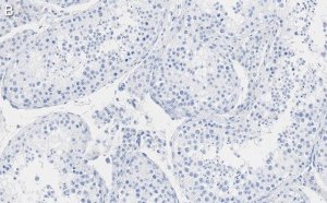 Anti-FKBP52 Antibody, clone 4H21 ZooMAb Rabbit Monoclonal 