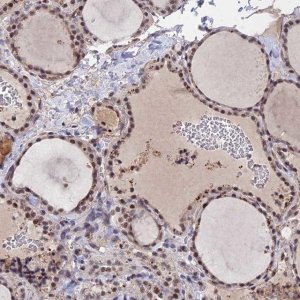 Anti-FKBPL antibody produced in rabbit 