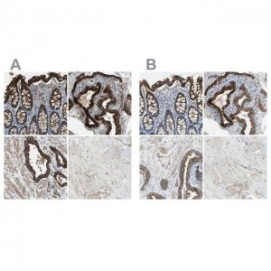 Anti-FLNB antibody produced in rabbit 