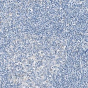 Anti-FLNC antibody produced in rabbit 