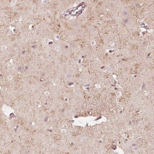 Anti-FMNL2 antibody produced in rabbit 