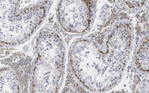 Anti-FMR1 (C-terminal) Antibody, clone 2B16 ZooMAb Rabbit Monoclonal 