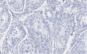 Anti-FMR1 (C-terminal) Antibody, clone 2B16 ZooMAb Rabbit Monoclonal 