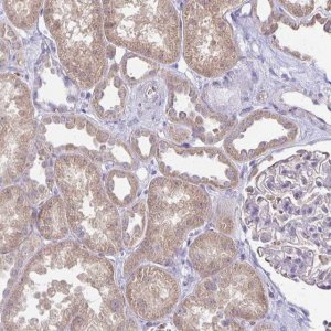 Anti-FN3K antibody produced in rabbit 