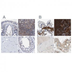Anti-FNBP1 