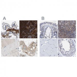 Anti-FNBP1 antibody produced in rabbit 