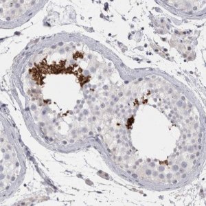 Anti-FNDC8 antibody produced in rabbit 
