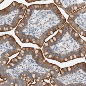 Anti-FNDC9 antibody produced in rabbit 