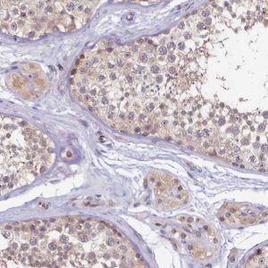 Anti-FOPNL antibody produced in rabbit 