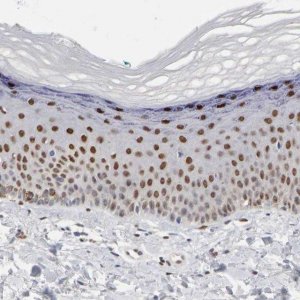 Anti-FOSL2 antibody produced in rabbit 