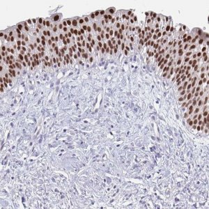 Anti-FOXA1 antibody produced in rabbit 