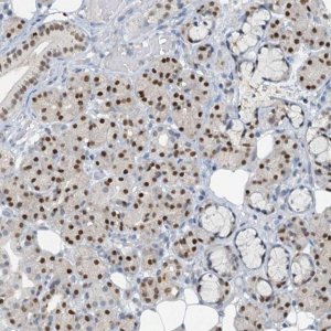 Anti-FOXC1 antibody produced in rabbit 