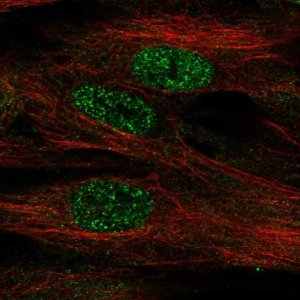 Anti-FOXF1 antibody produced in rabbit HPA028886-100UL
