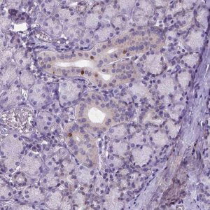 Anti-FOXI1 antibody produced in rabbit 