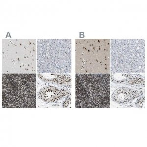 Anti-FOXK1 antibody produced in rabbit HPA018864-100UL