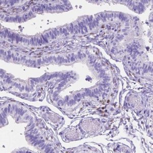 Anti-FOXL2 antibody produced in rabbit 