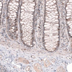 Anti-FOXM1 antibody produced in rabbit 