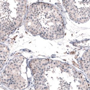 Anti-FOXM1 antibody produced in rabbit 