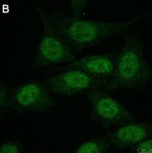 Anti-FoxP3 Antibody, clone 4J2 ZooMAb Rabbit Monoclonal 