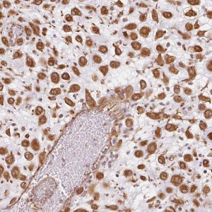 Anti-FOXR2 antibody produced in rabbit 