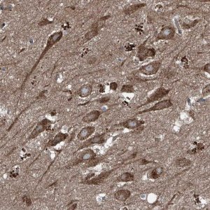 Anti-FOXRED2 antibody produced in rabbit 