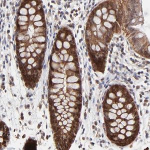 Anti-FRMD8 antibody produced in rabbit 