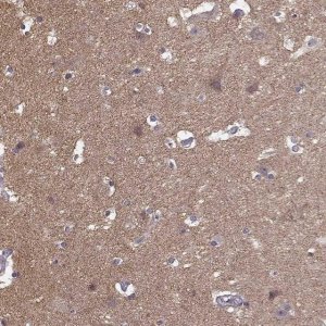 Anti-FRRS1L antibody produced in rabbit 