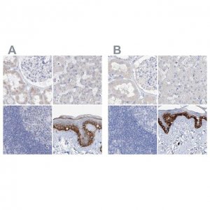 Anti-FRS3 antibody produced in rabbit 