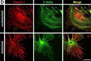 Anti-FSCN1 antibody produced in rabbit 