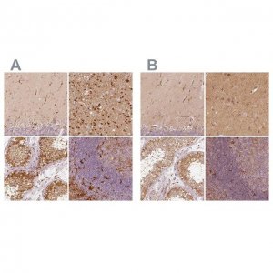 Anti-FSCN1 antibody produced in rabbit 