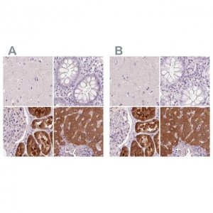 Anti-FTCD antibody produced in rabbit 
