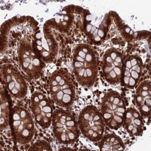 Anti-FUBP3 antibody produced in rabbit 