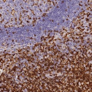 Anti-FYB antibody produced in rabbit 