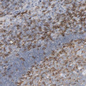 Anti-FYN antibody produced in rabbit 