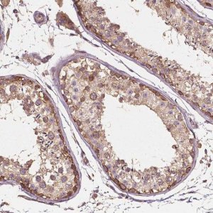 Anti-G3BP1 antibody produced in rabbit 