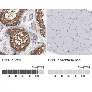 Anti-G6PD antibody produced in rabbit 