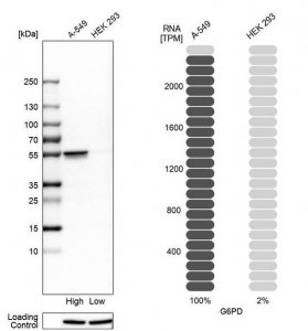 Anti-G6PD antibody produced in rabbit 