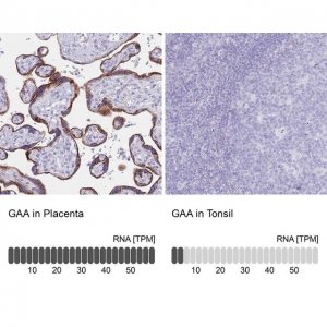 Anti-GAA antibody produced in rabbit 