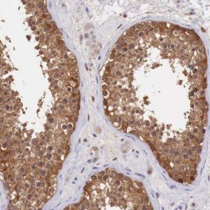 Anti-GAB2 antibody produced in rabbit 