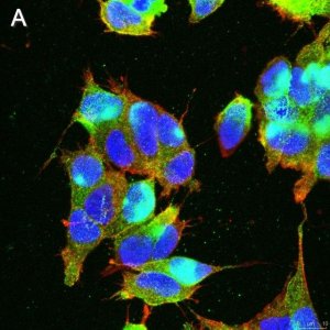 Anti-GABA A Receptor 1 Antibody, clone 3H10 ZooMAb Rabbit Monoclonal 