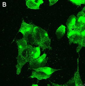 Anti-GABA A Receptor 1 Antibody, clone 3H10 ZooMAb Rabbit Monoclonal 