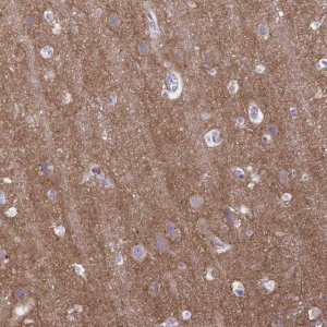 Anti-GABBR2 antibody produced in rabbit 