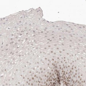Anti-GABPA antibody produced in rabbit HPA028791-100UL